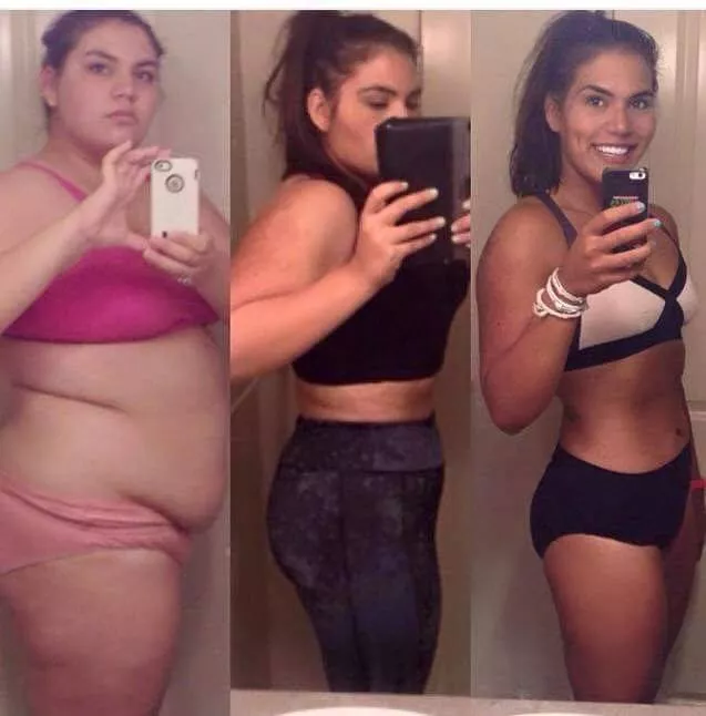 Girl-weight-loss-transformation (2)